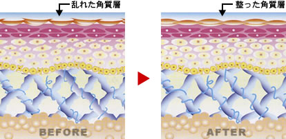 施術前と後の肌の組織