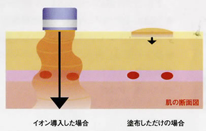 イオン導入図